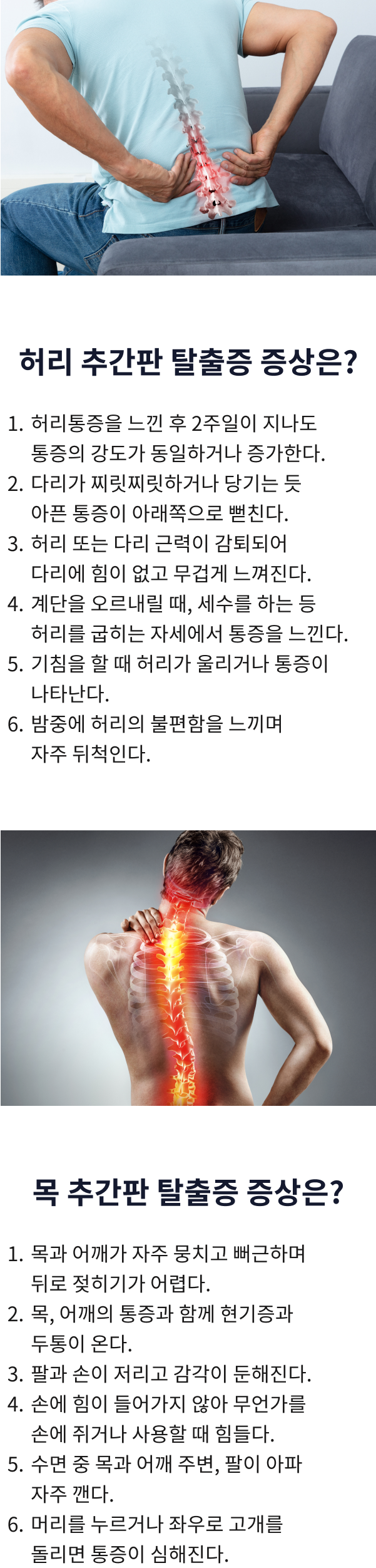 디스크 탈출증이란?